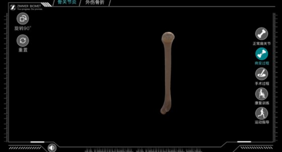 反肩手术模拟ios版 V1.0